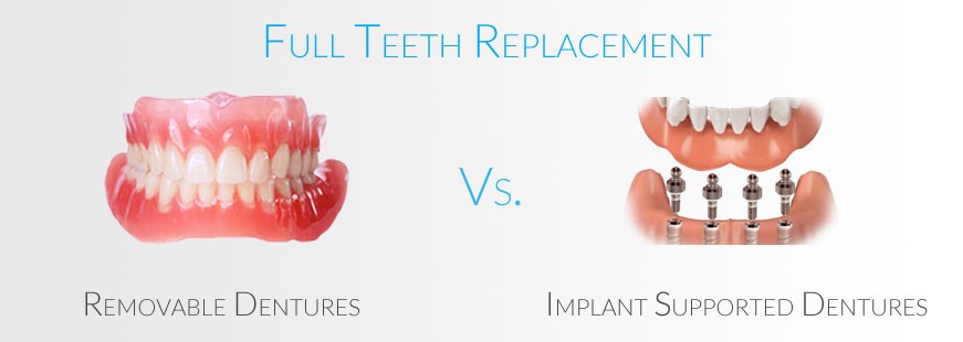 Different Types Of Dentures Shelbyville TN 37161